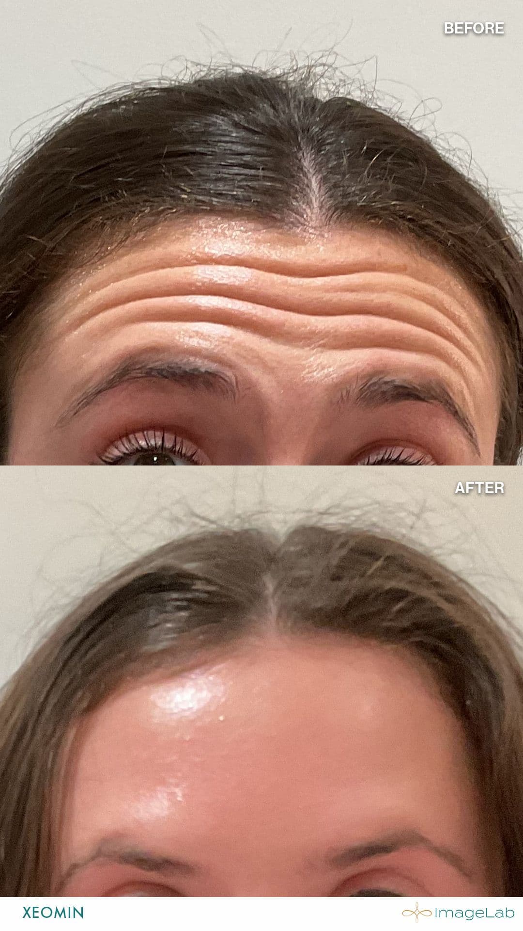 Before and after result