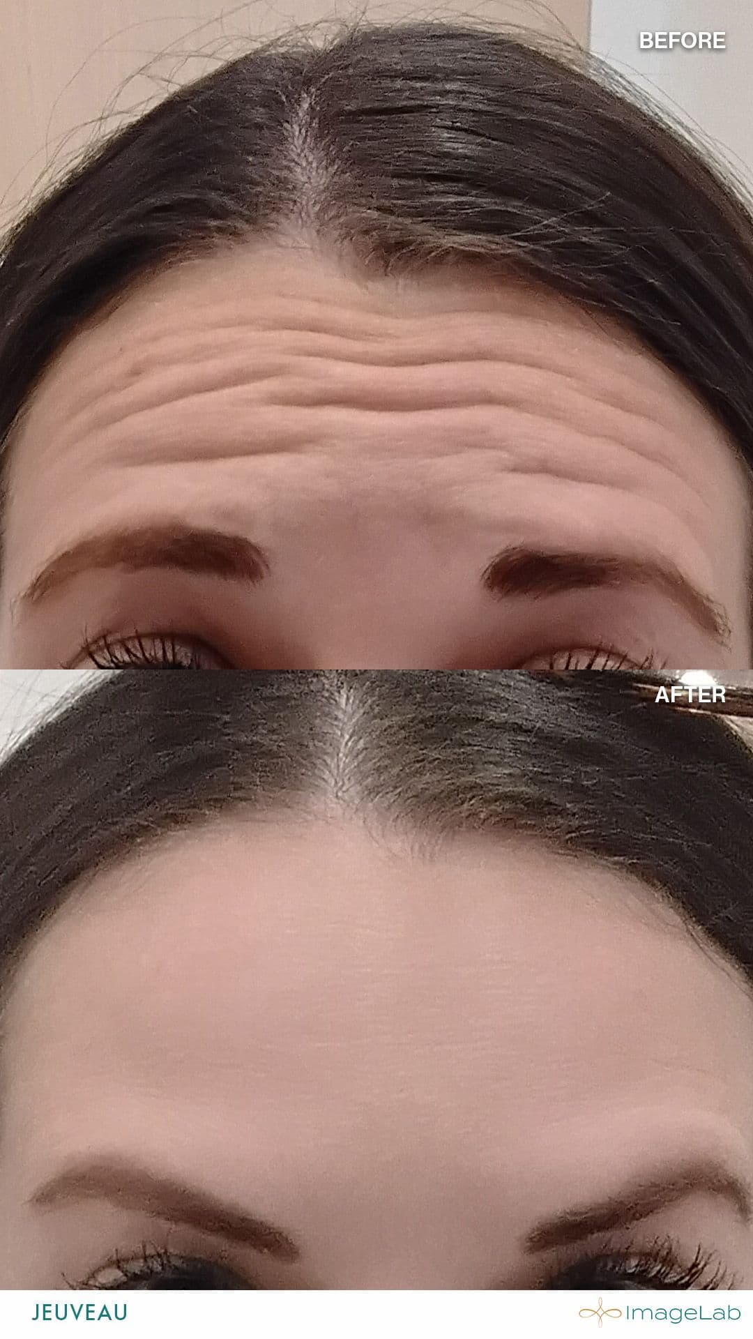 Before and after result