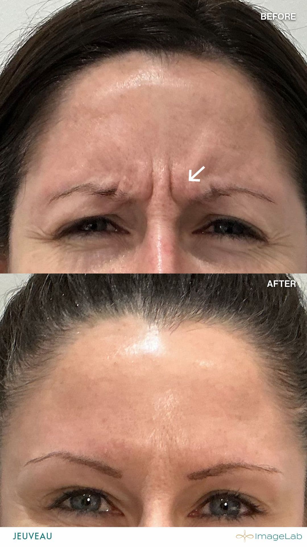Before and after result