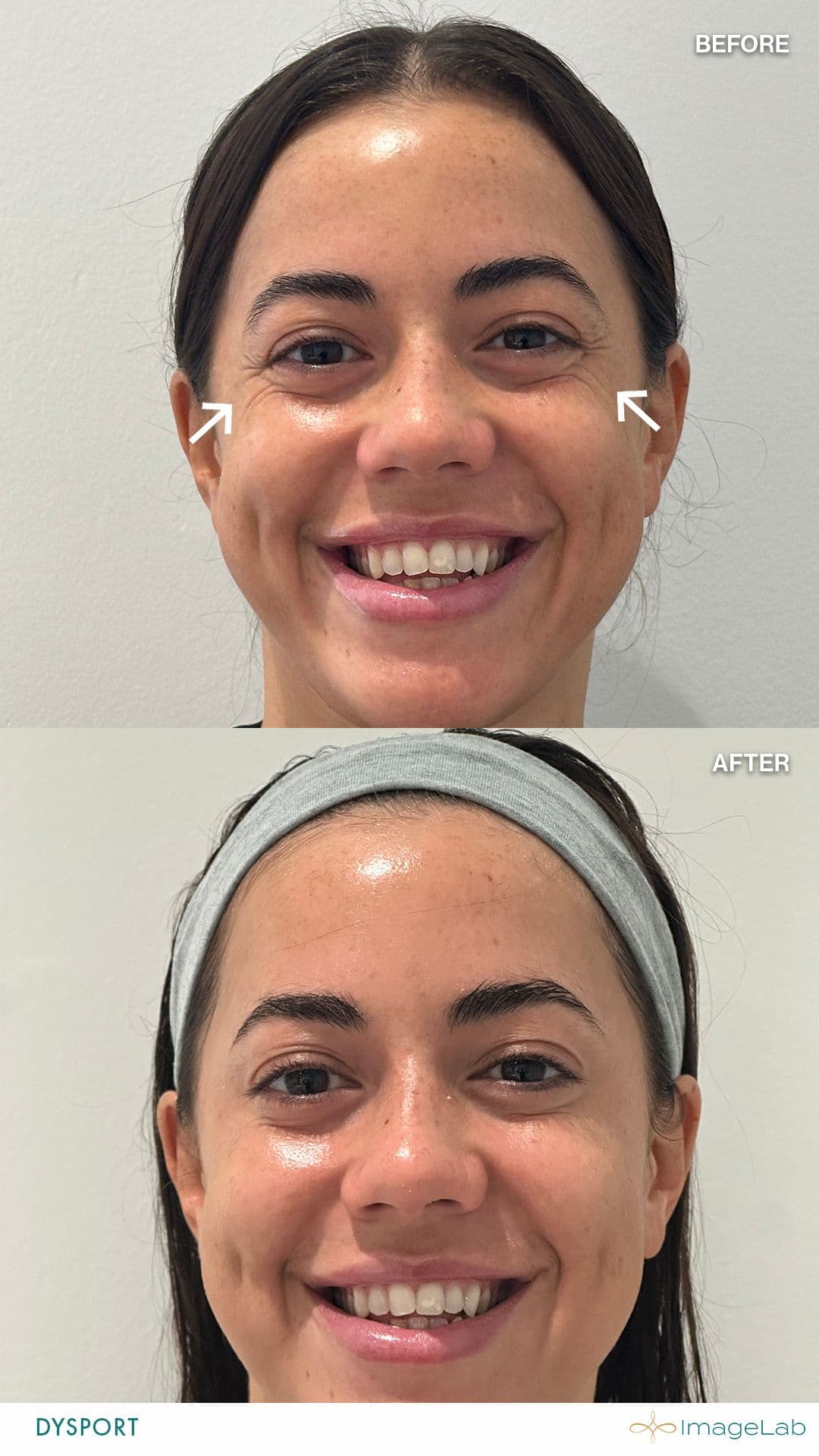 Before and after result
