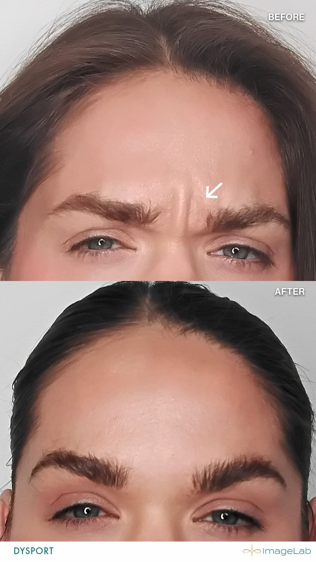 Before and after result