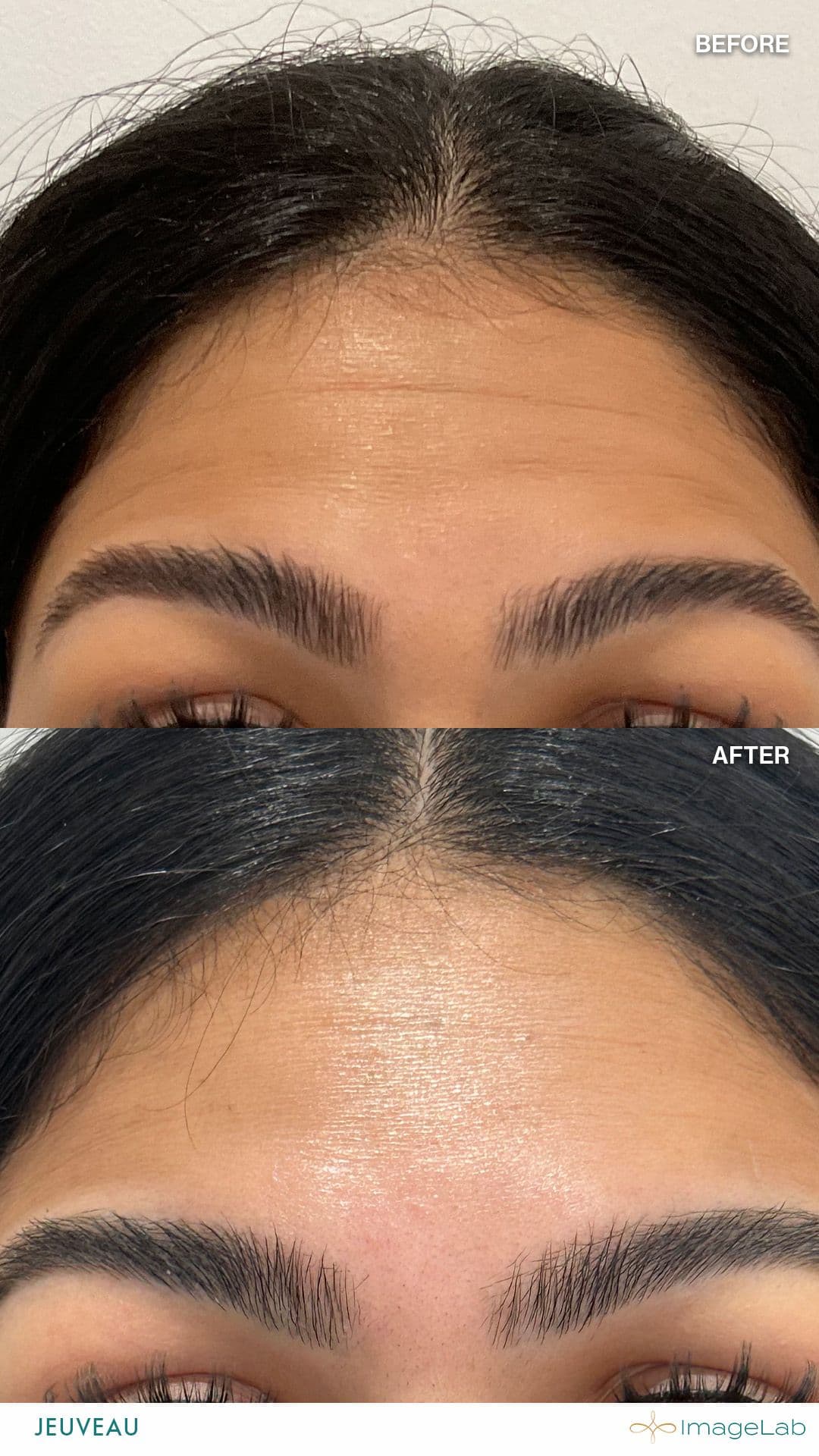Before and after result