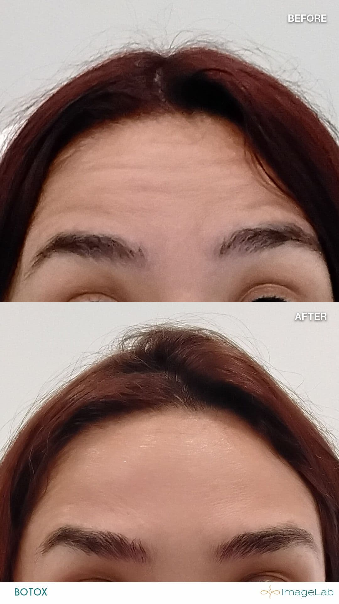 Before and after result