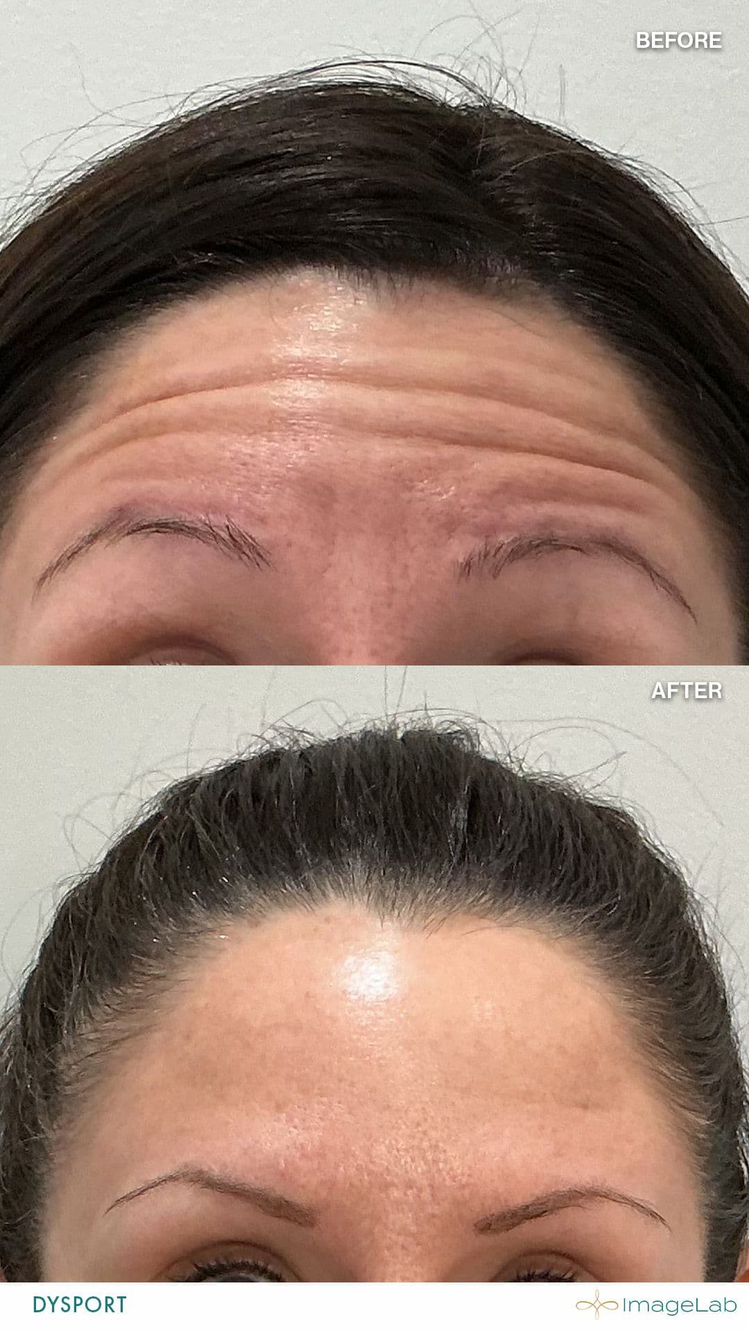 Before and after result