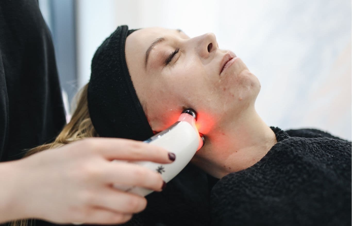 facial laser resurfacing
