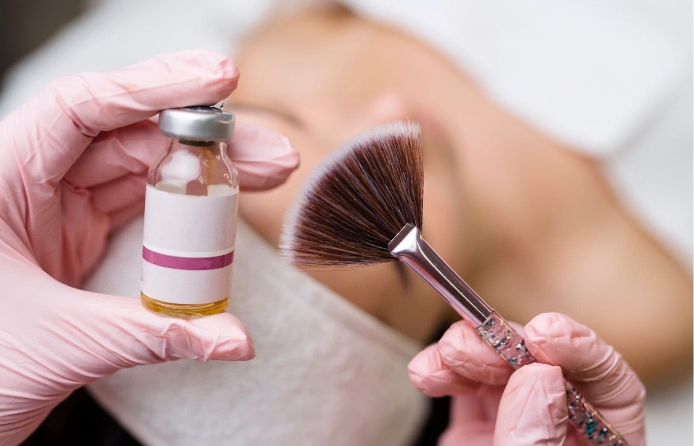 medical grade chemical peel