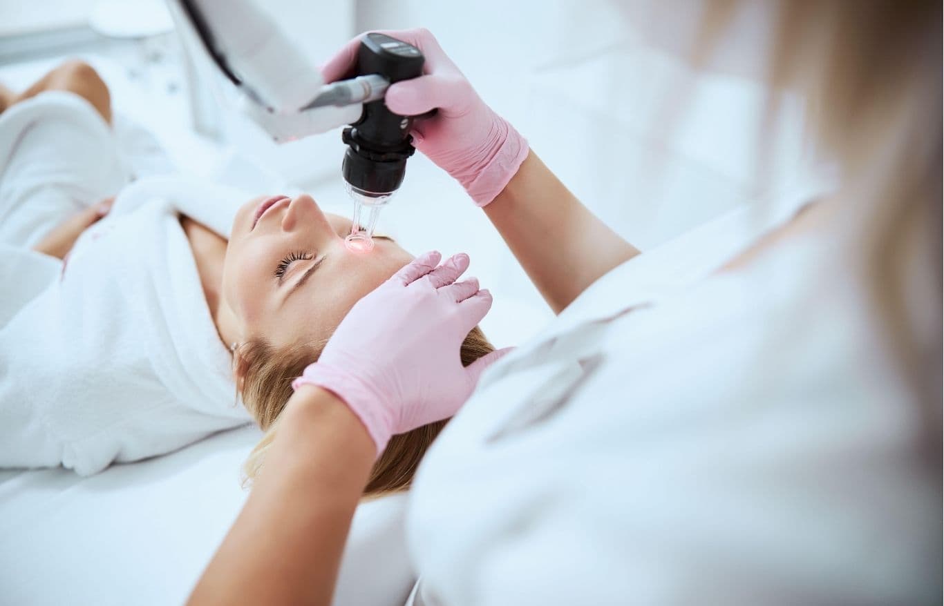 fractionated laser resurfacing