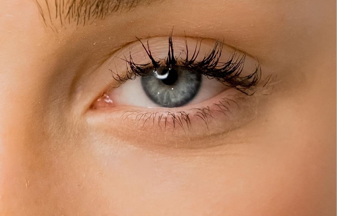PRP Under Eyes Treatment