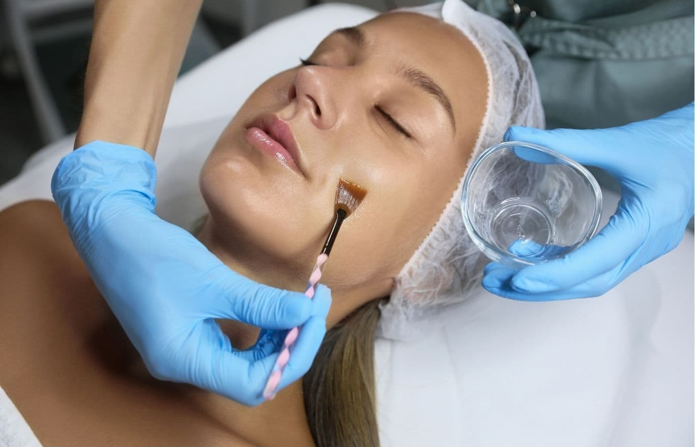 Temporary Darkening of Treated Areas