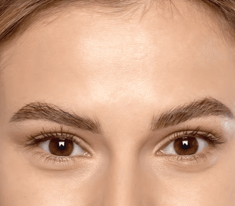 Temporary Redness, Swelling, or Bruising